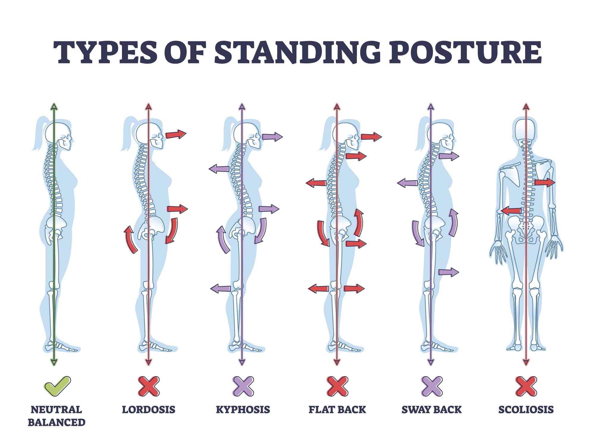 Types of Posture